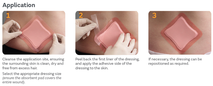 Allevyn Gentle Boeder - Foam Dressings